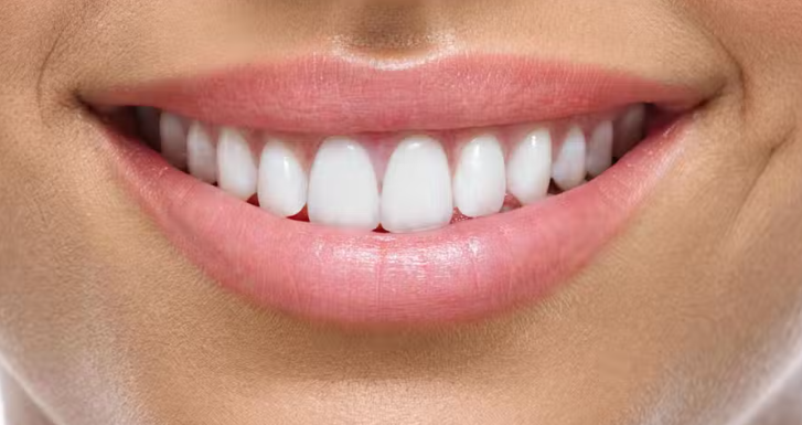 202303220942486 mouth